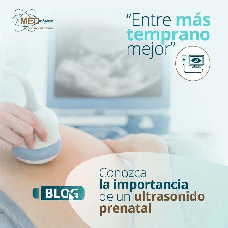 ultrasonido prenatal